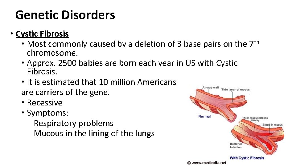 Genetic Disorders • Cystic Fibrosis • Most commonly caused by a deletion of 3