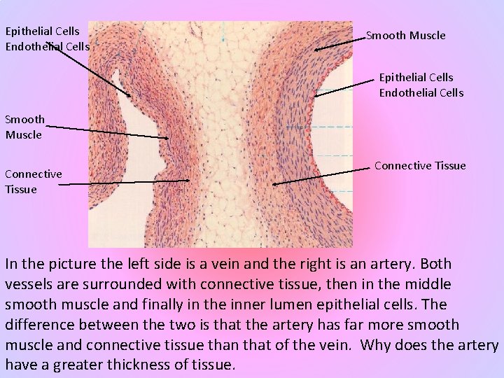 Epithelial Cells Endothelial Cells Smooth Muscle Connective Tissue In the picture the left side