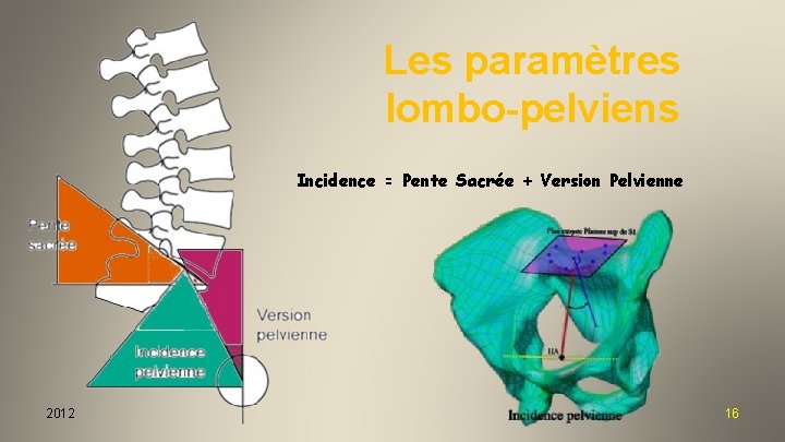 Les paramètres lombo-pelviens Incidence = Pente Sacrée + Version Pelvienne 2012 16 