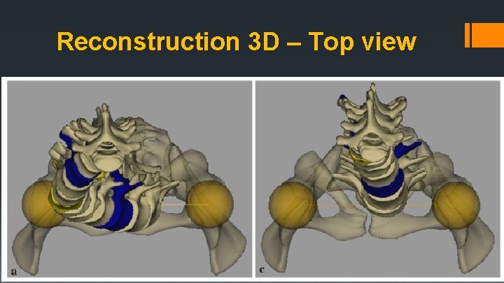 Reconstruction 3 D – Top view 