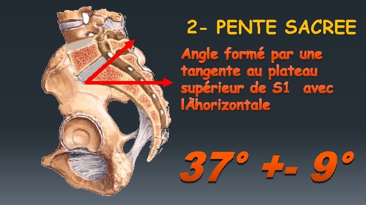 2 - PENTE SACREE Angle formé par une tangente au plateau supérieur de S