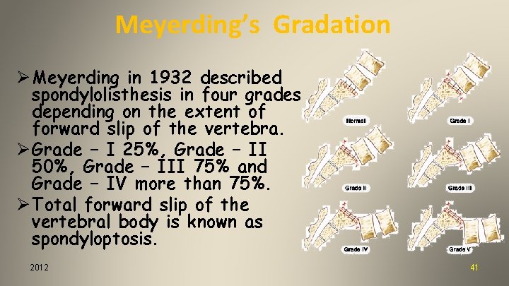 Meyerding’s Gradation Ø Meyerding in 1932 described spondylolisthesis in four grades depending on the