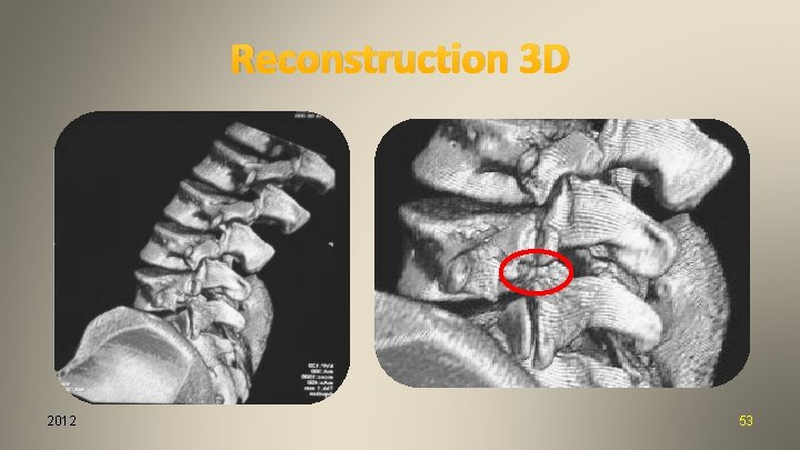 Reconstruction 3 D 2012 53 