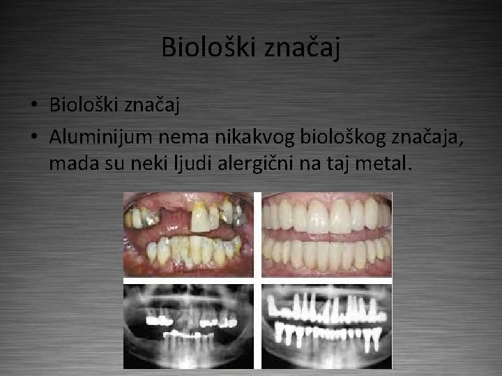 Biološki značaj • Aluminijum nema nikakvog biološkog značaja, mada su neki ljudi alergični na