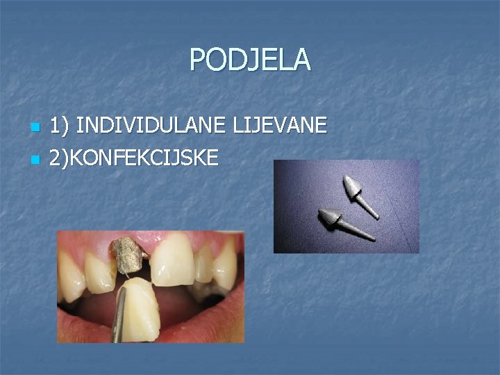 PODJELA n n 1) INDIVIDULANE LIJEVANE 2)KONFEKCIJSKE 