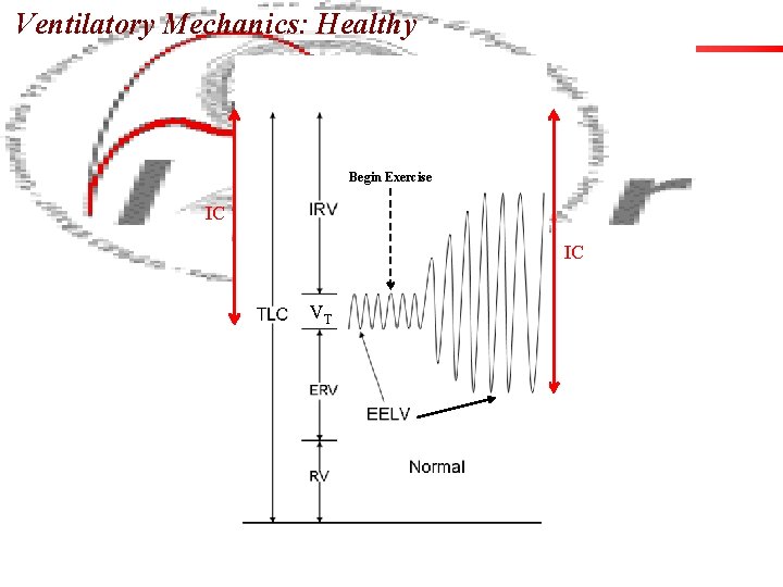 Ventilatory Mechanics: Healthy Begin Exercise IC IC VT 