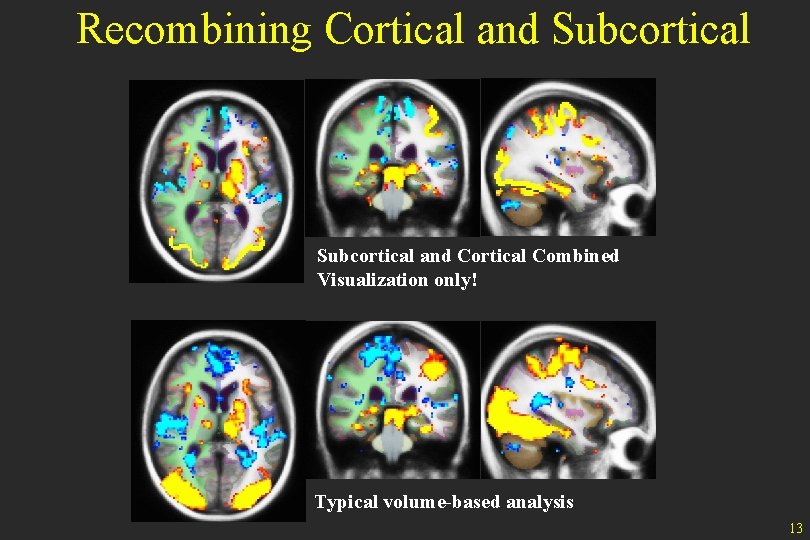 Recombining Cortical and Subcortical and Cortical Combined Visualization only! Typical volume-based analysis 13 