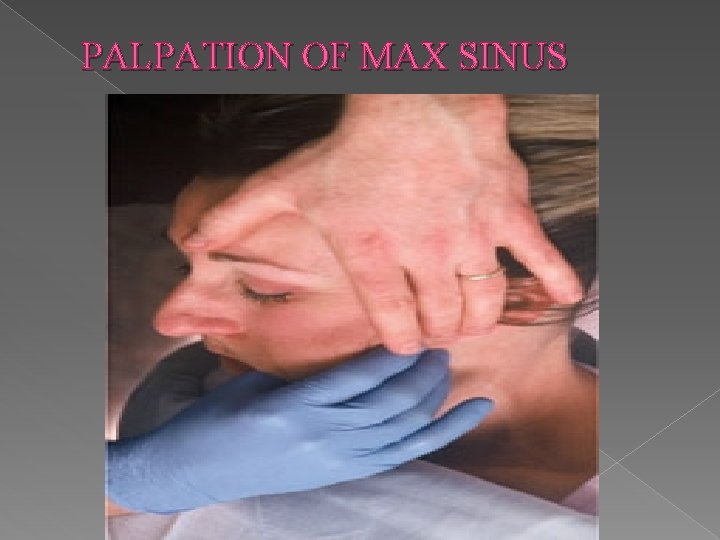 PALPATION OF MAX SINUS 