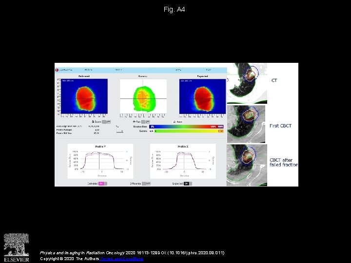 Fig. A 4 Physics and Imaging in Radiation Oncology 2020 16113 -129 DOI: (10.