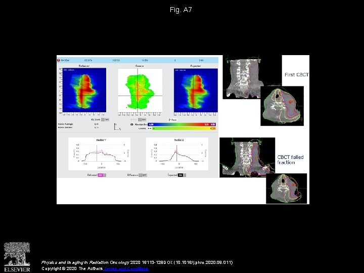 Fig. A 7 Physics and Imaging in Radiation Oncology 2020 16113 -129 DOI: (10.