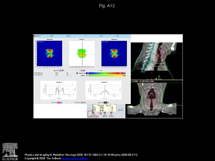 Fig. A 12 Physics and Imaging in Radiation Oncology 2020 16113 -129 DOI: (10.