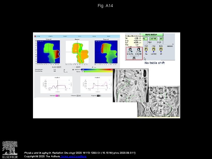 Fig. A 14 Physics and Imaging in Radiation Oncology 2020 16113 -129 DOI: (10.