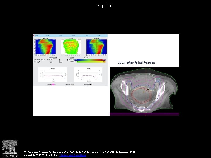 Fig. A 15 Physics and Imaging in Radiation Oncology 2020 16113 -129 DOI: (10.