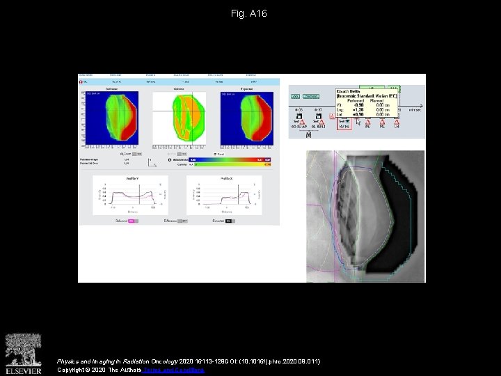 Fig. A 16 Physics and Imaging in Radiation Oncology 2020 16113 -129 DOI: (10.