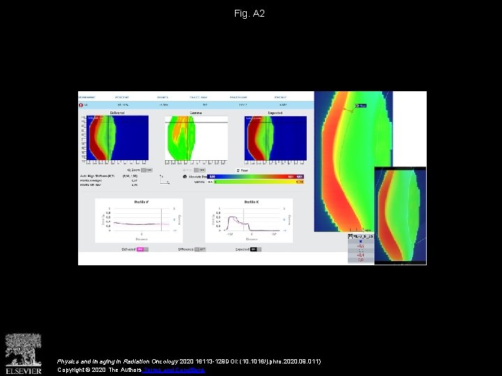 Fig. A 2 Physics and Imaging in Radiation Oncology 2020 16113 -129 DOI: (10.