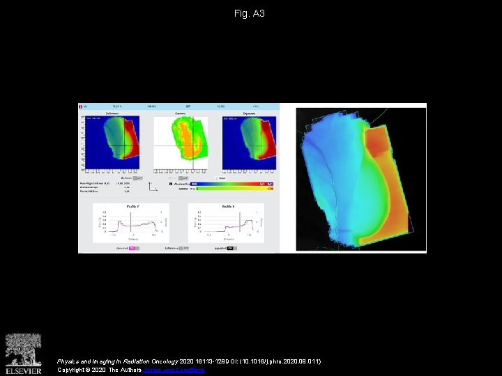 Fig. A 3 Physics and Imaging in Radiation Oncology 2020 16113 -129 DOI: (10.