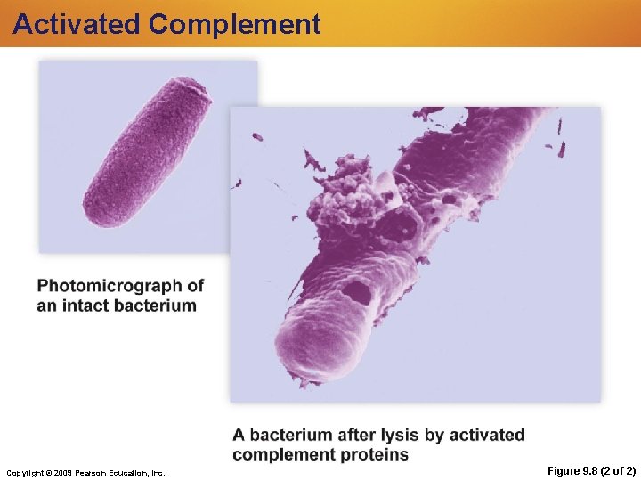 Activated Complement Copyright © 2009 Pearson Education, Inc. Figure 9. 8 (2 of 2) Activated Complement Copyright © 2009 Pearson Education, Inc. Figure 9. 8 (2 of 2)