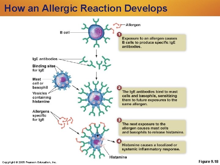 How an Allergic Reaction Develops Copyright © 2009 Pearson Education, Inc. Figure 9. 18 How an Allergic Reaction Develops Copyright © 2009 Pearson Education, Inc. Figure 9. 18