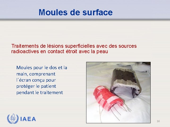 Moules de surface Traitements de lésions superficielles avec des sources radioactives en contact étroit