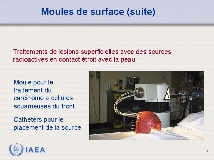 Moules de surface (suite) Traitements de lésions superficielles avec des sources radioactives en contact