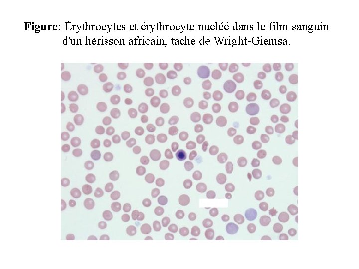 Figure: Érythrocytes et érythrocyte nucléé dans le film sanguin d'un hérisson africain, tache de