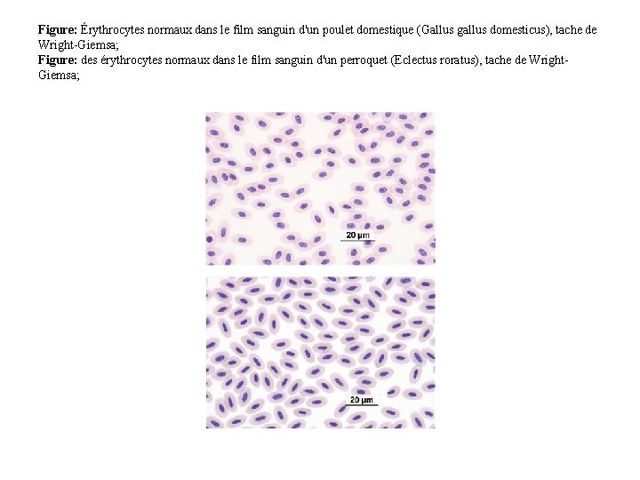Figure: Érythrocytes normaux dans le film sanguin d'un poulet domestique (Gallus gallus domesticus), tache