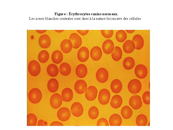 Figure : Érythrocytes canins normaux. Les zones blanches centrales sont dues à la nature