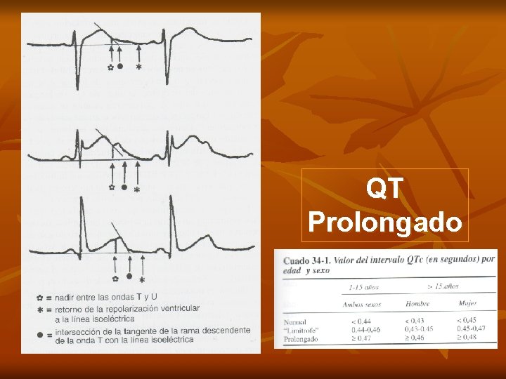 QT Prolongado 