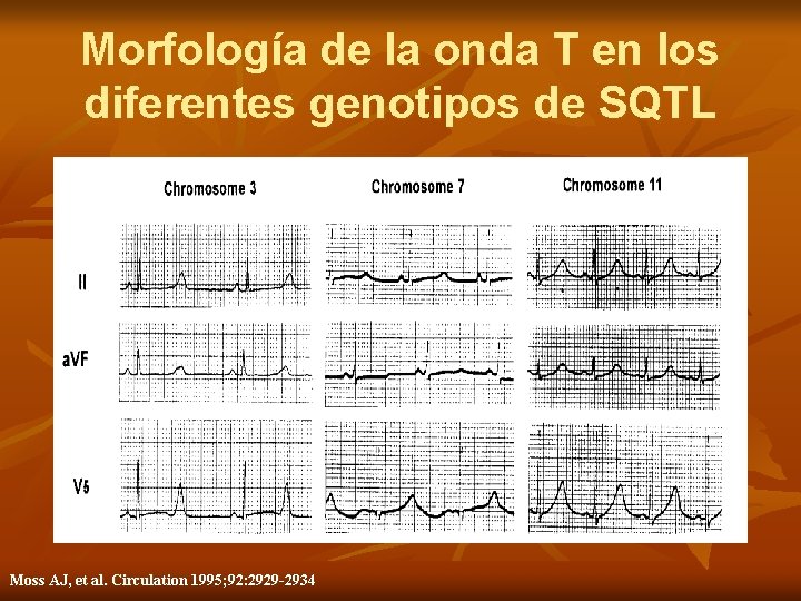 Morfología de la onda T en los diferentes genotipos de SQTL Moss AJ, et