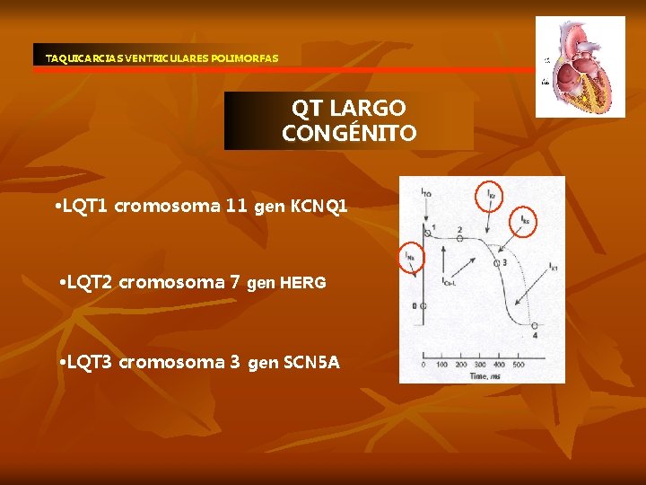 TAQUICARCIAS VENTRICULARES POLIMORFAS QT LARGO CONGÉNITO • LQT 1 cromosoma 11 gen KCNQ 1