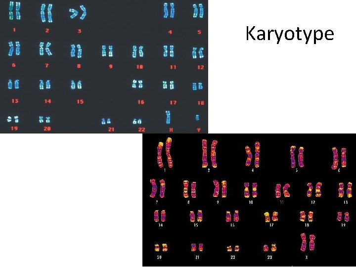 Karyotype 