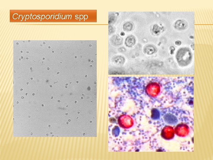 Cryptosporidium spp 