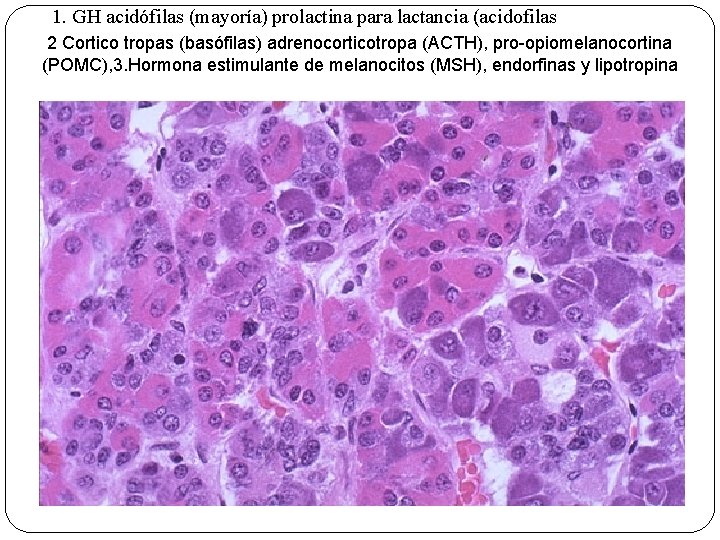 1. GH acidófilas (mayoría) prolactina para lactancia (acidofilas 2 Cortico tropas (basófilas) adrenocorticotropa (ACTH),