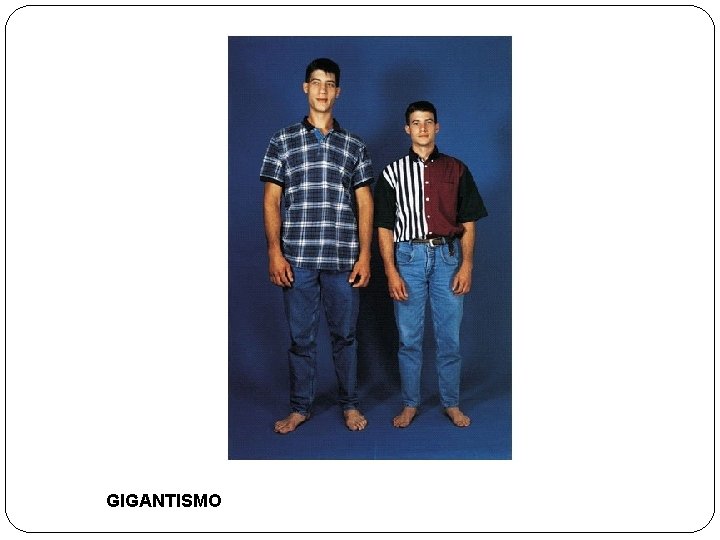 GIGANTISMO 