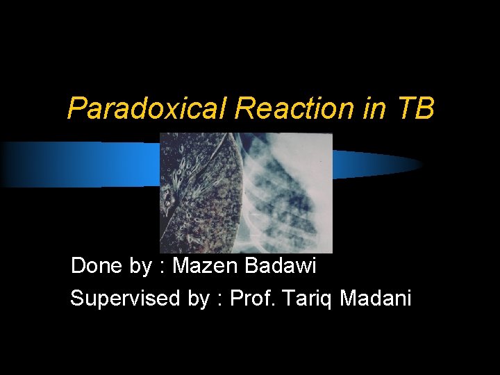 Paradoxical Reaction in TB Done by : Mazen Badawi Supervised by : Prof. Tariq