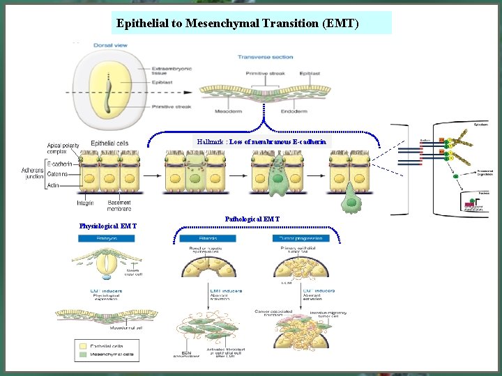Epithelial to Mesenchymal Transition EMT Hallmark Loss of