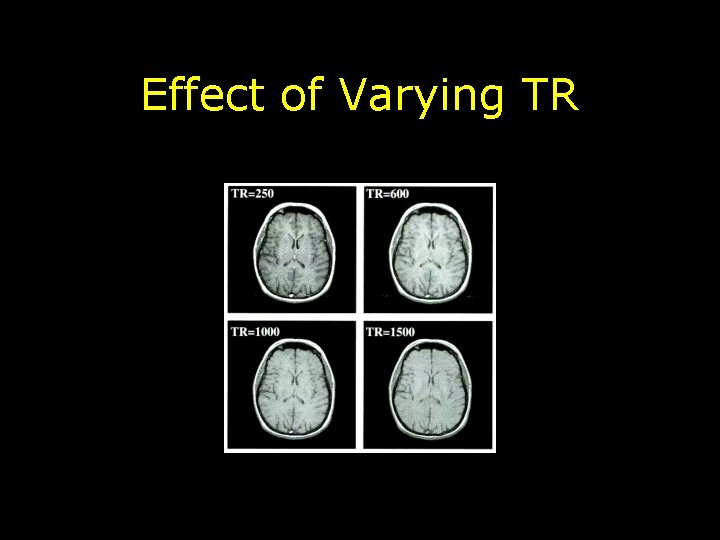 Effect of Varying TR 