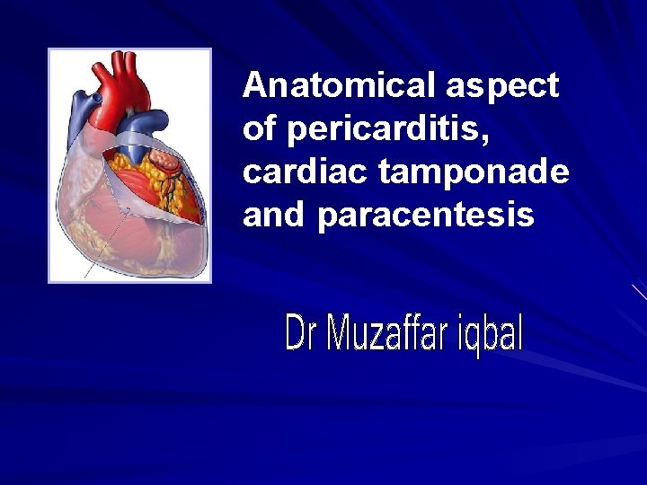 Anatomical aspect of pericarditis, cardiac tamponade and paracentesis 