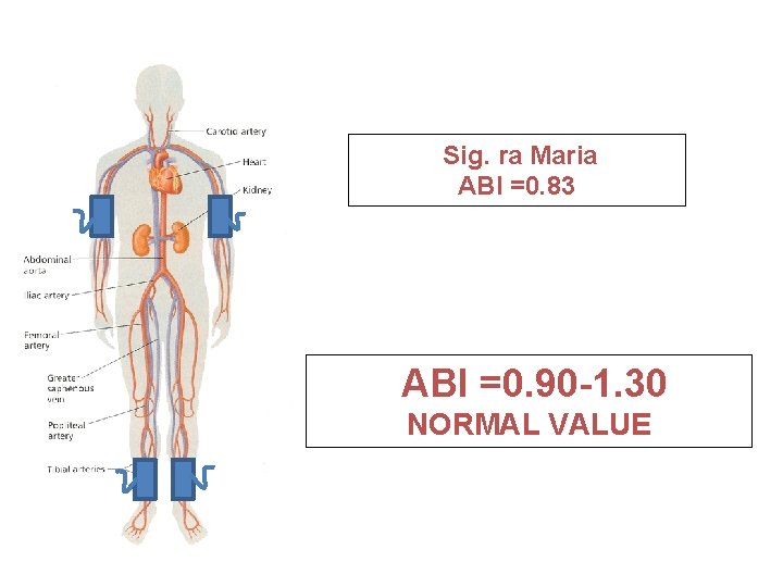 Sig. ra Maria ABI =0. 83 ABI =0. 90 -1. 30 NORMAL VALUE 