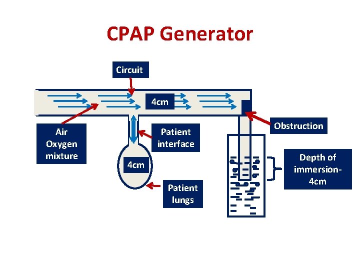 CPAP Generator Circuit 4 cm Air Oxygen mixture Patient interface 4 cm Patient lungs