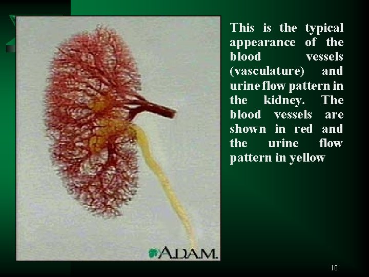 This is the typical appearance of the blood vessels (vasculature) and urine flow pattern