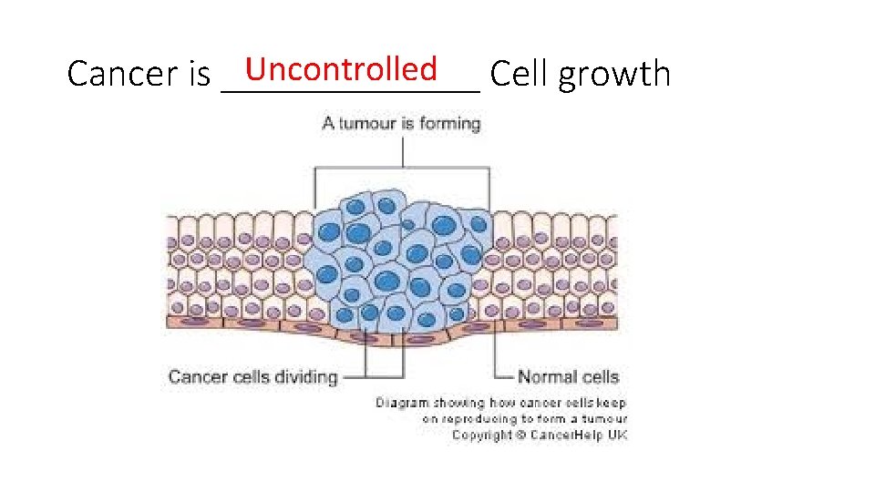 Uncontrolled Cell growth Cancer is _______ 