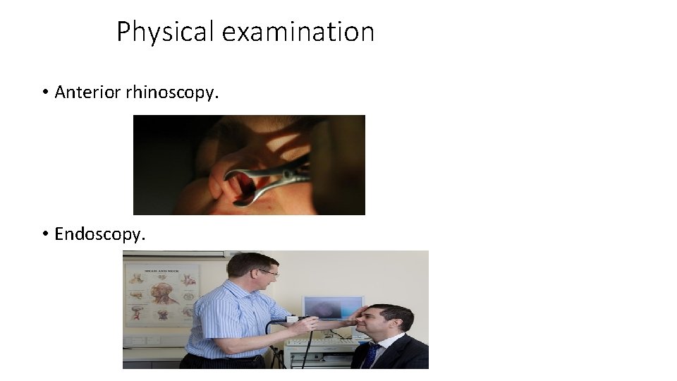 Physical examination • Anterior rhinoscopy. • Endoscopy. 