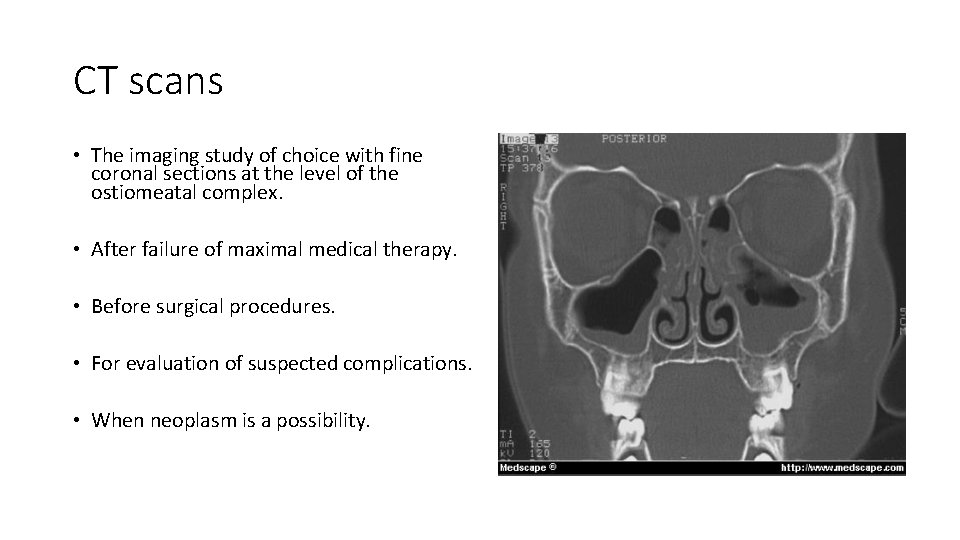 CT scans • The imaging study of choice with fine coronal sections at the