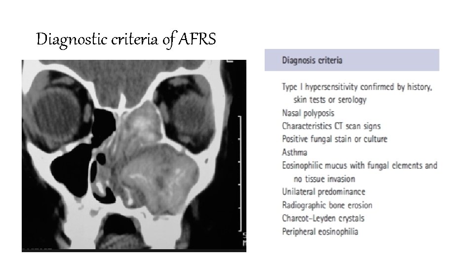 Diagnostic criteria of AFRS 