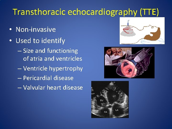 Transthoracic echocardiography (TTE) • Non-invasive • Used to identify – Size and functioning of