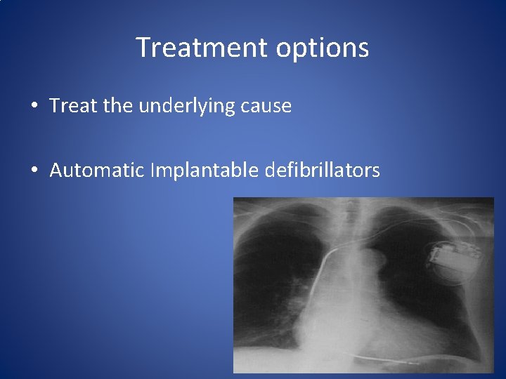 Treatment options • Treat the underlying cause • Automatic Implantable defibrillators 