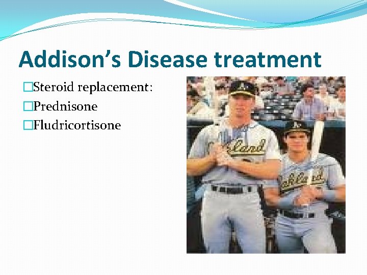 Addison’s Disease treatment �Steroid replacement: �Prednisone �Fludricortisone 