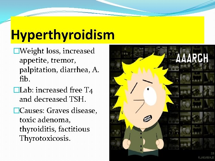 Hyperthyroidism �Weight loss, increased appetite, tremor, palpitation, diarrhea, A. fib. �Lab: increased free T