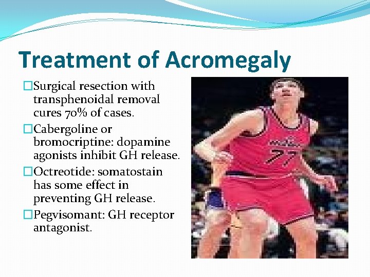 Treatment of Acromegaly �Surgical resection with transphenoidal removal cures 70% of cases. �Cabergoline or